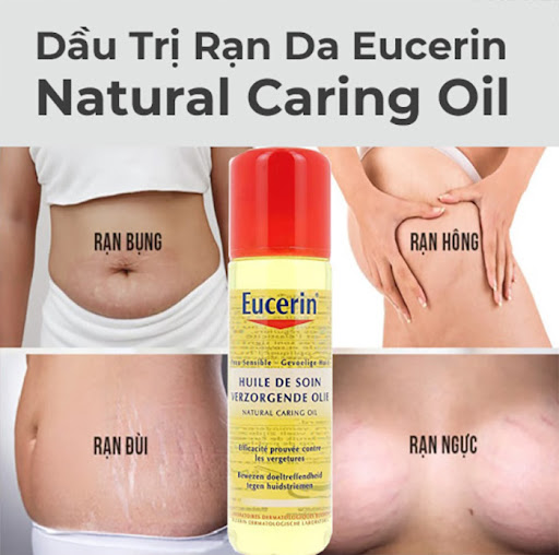 Ai có thể dùng dầu giảm rạn Eucerin Natural Caring Oil? Ai có thể dùng dầu giảm rạn Eucerin Natural Caring Oil?