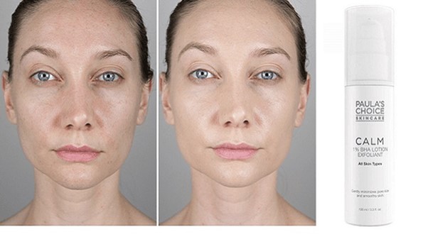 Hiệu quả khi dùng tẩy tế bào chết Paula’s Choice đã được kiểm nghiệm bởi hàng triệu khách hàng Hiệu quả khi dùng tẩy tế bào chết Paula’s Choice đã được kiểm nghiệm bởi hàng triệu khách hàng