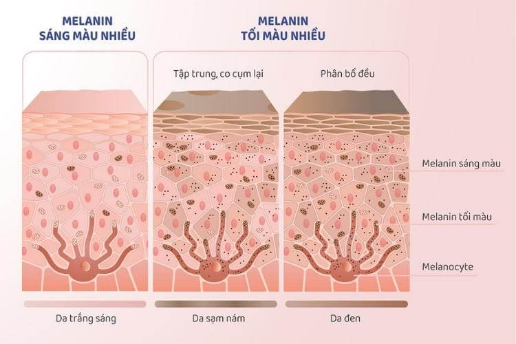 Màu sắc của da, tóc và mắt của con người phụ thuộc vào mức độ sản xuất melanin. Màu sắc của da, tóc và mắt của con người phụ thuộc vào mức độ sản xuất melanin.