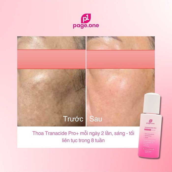 Hiệu quả nhanh chóng mà không gây bong tróc, mẩn đỏ Hiệu quả nhanh chóng mà không gây bong tróc, mẩn đỏ