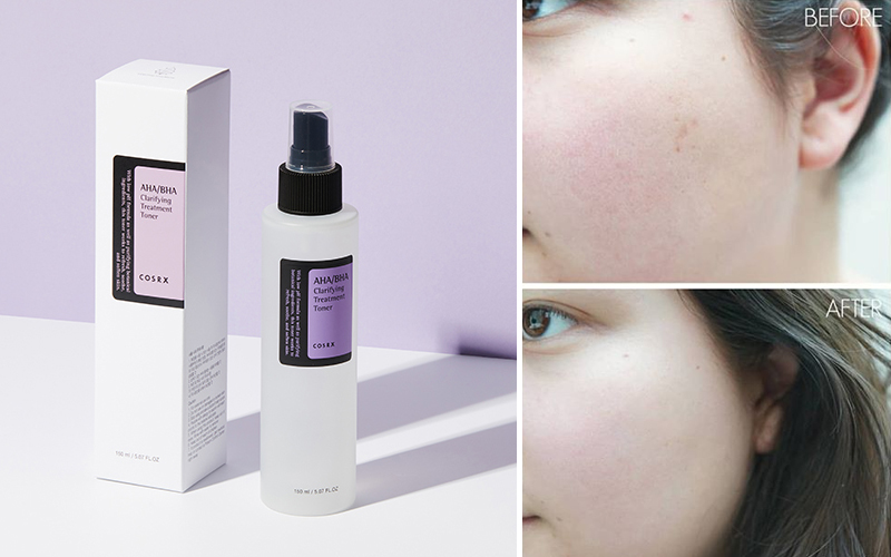 Nước hoa hồng Cosrx AHA/BHA Clarifying Treatment Toner Nước hoa hồng Cosrx AHA/BHA Clarifying Treatment Toner