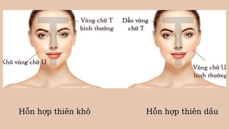 Da hỗn hợp thiên dầu là loại da có sự pha trộn của cả da khô và da dầu.