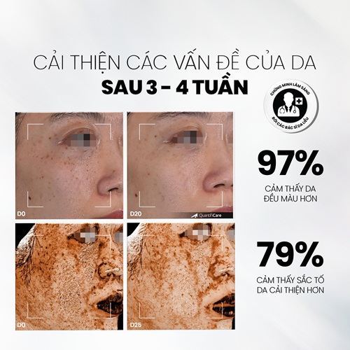 Serum sáng da, chống lão hóa MD CARE VitaC-Arbutin Serum – Whitening Advanced Formula