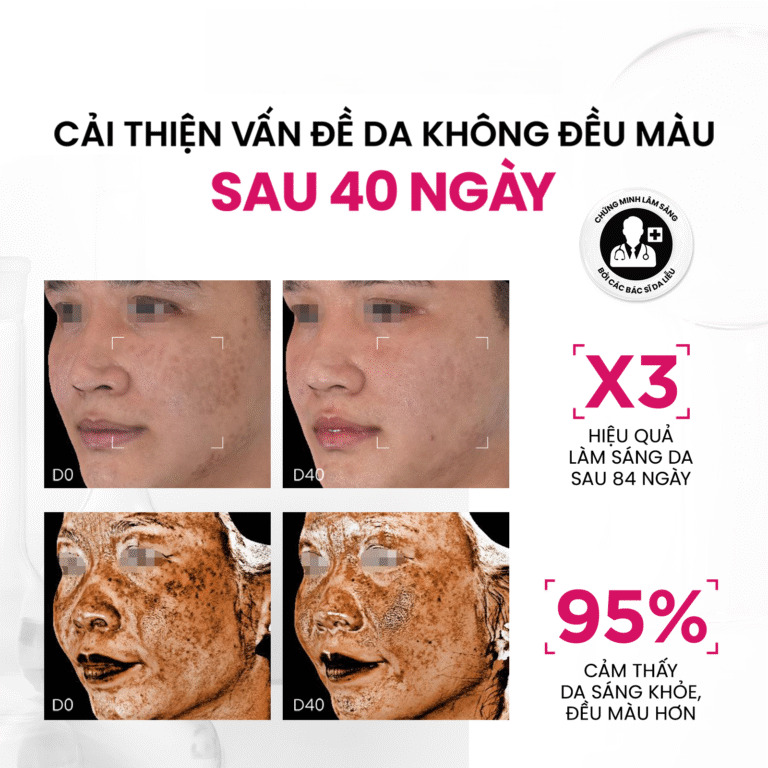  Tinh chất làm sáng da đa tầng MD CARE Brightenyl Serum Advanced Brightening Complex