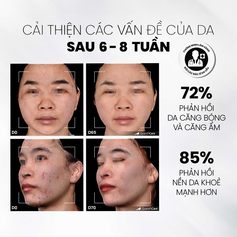 Tẩy tế bào chết, làm sáng và đều màu da MD CARE Glow Exfo
