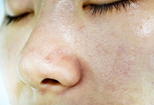 Paula’s Choice Skin Balancing Ultra-Sheer Daily Defense SPF 30 thích hợp cho làn da dầu, da bóng nhờn và lỗ chân lông to Paula’s Choice Skin Balancing Ultra-Sheer Daily Defense SPF 30 thích hợp cho làn da dầu, da bóng nhờn và lỗ chân lông to