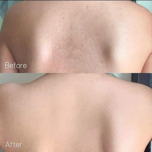 Paula’s Choice Resist Skin Revealing Body Lotion 10% AHA hỗ trợ cải thiện mụn lưng, giúp bề mặt da láng mịn tự nhiên