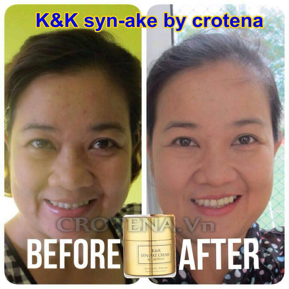 Kem dưỡng trắng da ban đêm Crotena Syn Ake Creamc có tốt hay không đã được kiểm chứng bởi người tiêu dùng