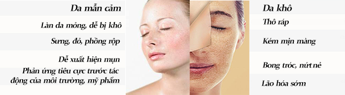 Giải pháp hoàn hảo cho làn da khô và da mẫn cảm Giải pháp hoàn hảo cho làn da khô và da mẫn cảm