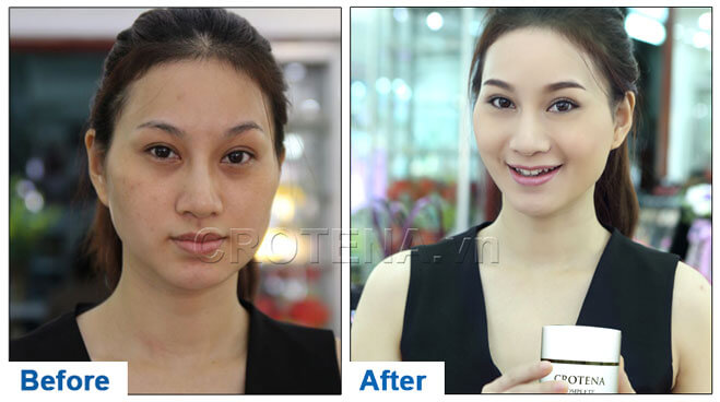 Bạn sẽ mua ngay Crotena Complete CC Cream để “biến hóa vi kỳ diệu” cho Tết này khi đọc những thông tin dưới đây hình ảnh 3 Bạn sẽ mua ngay Crotena Complete CC Cream để “biến hóa vi kỳ diệu” cho Tết này khi đọc những thông tin dưới đây hình ảnh 3