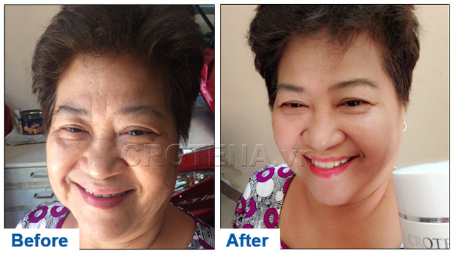 Bạn sẽ mua ngay Crotena Complete CC Cream để “biến hóa vi kỳ diệu” cho Tết này khi đọc những thông tin dưới đây hình ảnh 5 Bạn sẽ mua ngay Crotena Complete CC Cream để “biến hóa vi kỳ diệu” cho Tết này khi đọc những thông tin dưới đây hình ảnh 5