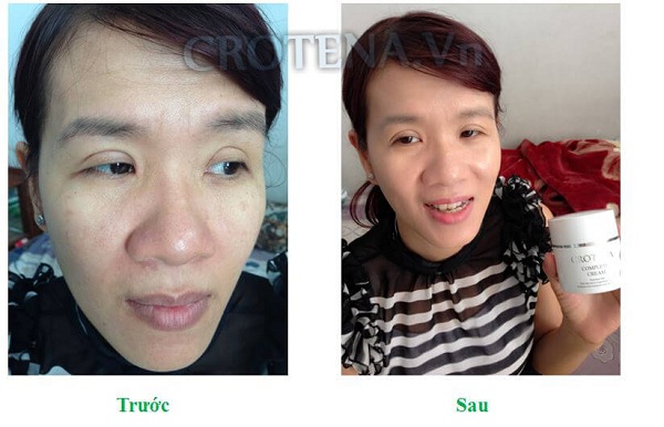 Bạn sẽ mua ngay Crotena Complete CC Cream để “biến hóa vi kỳ diệu” cho Tết này khi đọc những thông tin dưới đây hình ảnh 8 Bạn sẽ mua ngay Crotena Complete CC Cream để “biến hóa vi kỳ diệu” cho Tết này khi đọc những thông tin dưới đây hình ảnh 8