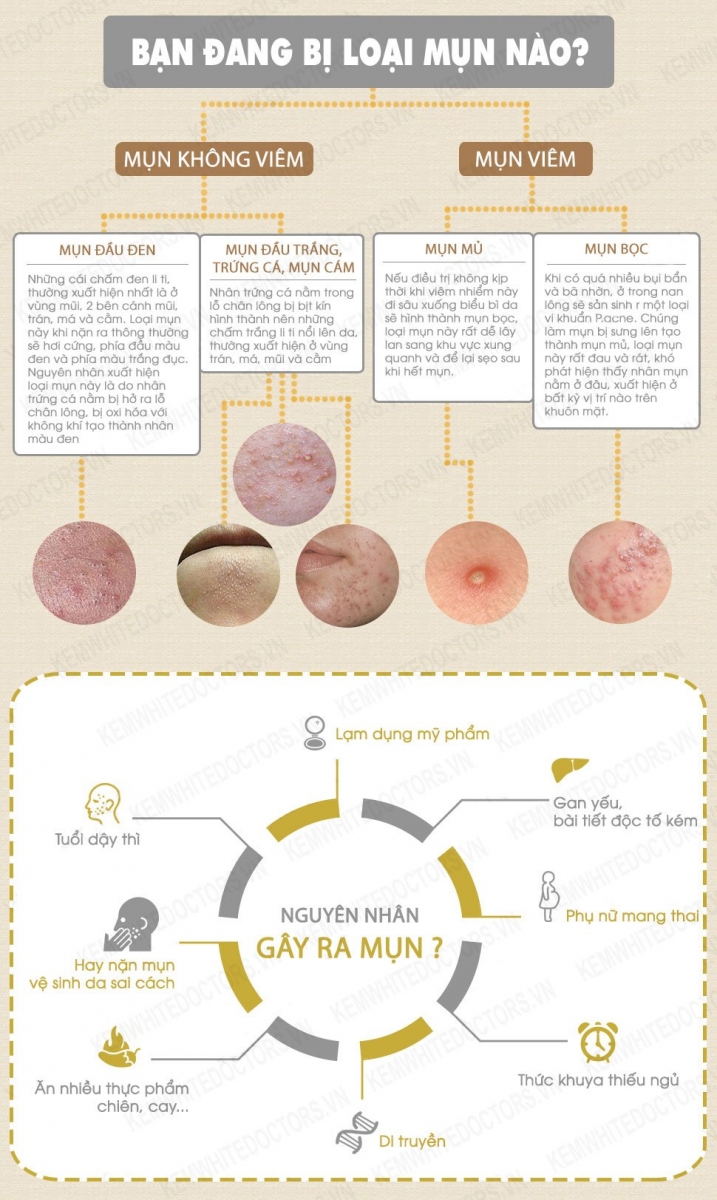 3 Cách Đắp Mặt Nạ Rau Diếp Cá Giúp Da Căng Mịn