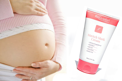 Kem trị rạn da Stretch Mark
