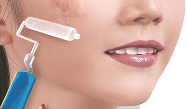 Top 3 Loại Kem Hỗ Trợ Làm Mờ Sẹo Tận Gốc 100% Bán Chạy Nhất Năm 2018